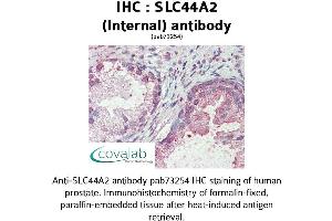 Image no. 2 for anti-Solute Carrier Family 44, Member 2 (SLC44A2) (Internal Region) antibody (ABIN1739381) (SLC44A2 antibody  (Internal Region))