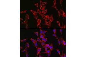 Immunofluorescence (IF) image for anti-Fibroblast Growth Factor Receptor 3 (FGFR3) (AA 39-138) antibody (ABIN1679839)