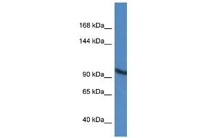 Western Blot showing ZMIZ2 antibody used at a concentration of 1 ug/ml against A549 Cell Lysate (ZMIZ2 antibody  (Middle Region))