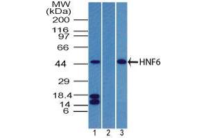 Image no. 2 for anti-One Cut Homeobox 1 (ONECUT1) (AA 420-470) antibody (ABIN960298) (ONECUT1 antibody  (AA 420-470))