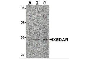 Western Blotting (WB) image for anti-Ectodysplasin A2 Receptor (EDA2R) antibody (ABIN2477154) (Ectodysplasin A2 Receptor antibody)