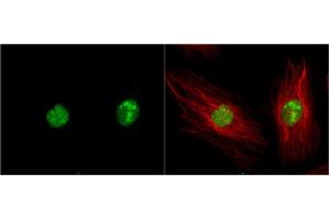 ICC/IF Image DAP Kinase 3 antibody detects DAP Kinase 3 protein at nucleus by immunofluorescent analysis. (DAPK3 antibody  (N-Term))