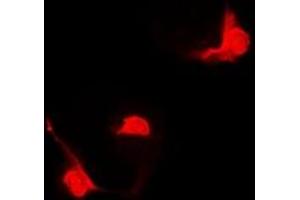 Immunofluorescent analysis of STAT5B staining in Hela cells. (STAT5B antibody)
