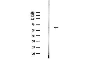 Western blot analysis of lysates from  cells(heat-shock,45 min treatment), using KCNQ1 Antibody at 1/1000 dilution.