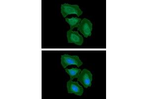 ICC/IF analysis of ITGB1 in HeLa cells. (ITGB1 antibody  (AA 21-461))
