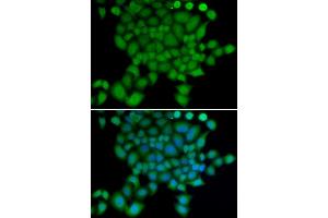 Immunofluorescence analysis of U2OS cells using NEDD9 antibody. (NEDD9 antibody)