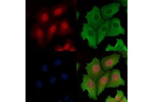 ABIN6261878 and ABIN6266545 staining Hela cells by IF/ICC.