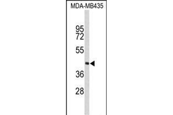 PHYH antibody  (N-Term)