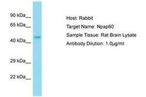 Image no. 1 for anti-Nucleoporin 50kDa (NUP50) (AA 21-70) antibody (ABIN6750333) (NUP50 antibody  (AA 21-70))