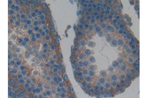 Used in DAB staining on fromalin fixed paraffin- embedded kidney tissue (LIFR antibody  (AA 152-291))