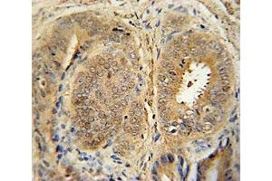 Immunohistochemistry (IHC) image for anti-Mdm2, p53 E3 Ubiquitin Protein Ligase Homolog (Mouse) (MDM2) (AA 393-424) antibody (ABIN3031739)