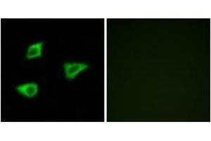 Immunofluorescence analysis of LOVO cells, using CHRM4 Antibody. (CHRM4 antibody  (AA 236-285))