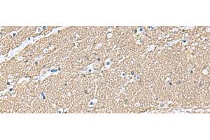 Immunohistochemistry of paraffin-embedded Human brain tissue using TAGLN3 Polyclonal Antibody at dilution of 1:70(x200) (Transgelin 3 antibody)