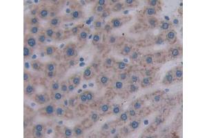 Used in DAB staining on fromalin fixed paraffin- embedded liver tissue (MTIF2 antibody  (AA 1-201))
