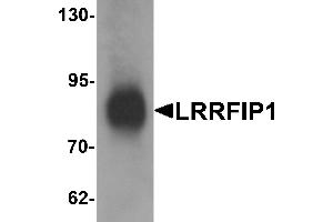 Western blot analysis of LRRFIP1 in human colon tissue lysate with LRRFIP1 antibody at 1 µg/mL. (LRRFIP1 antibody  (C-Term))