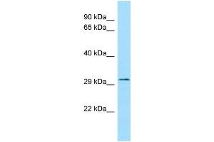 WB Suggested Anti-FLVCR2 Antibody Titration: 1. (FLVCR2 antibody  (C-Term))