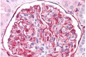 Human Kidney: Formalin-Fixed, Paraffin-Embedded (FFPE) (Vimentin antibody  (C-Term))