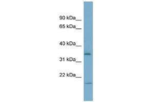WB Suggested Anti-IGFBP2 Antibody Titration: 0. (IGFBP2 antibody  (Middle Region))