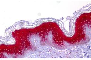 Anti-IVL / Involucrin antibody IHC staining of human skin. (Involucrin antibody)