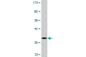 Western Blot detection against Immunogen (36. (AMPD2 antibody  (AA 86-185))