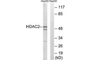 Western blot analysis of extracts from HepG2 cells, using HDAC2 (Ab-394) Antibody. (HDAC2 antibody  (AA 360-409))