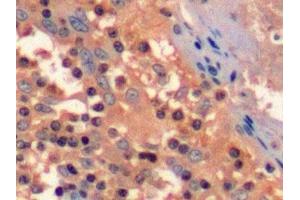 Detection of CD3d in Human Tonsil Tissue using Polyclonal Antibody to Cluster Of Differentiation 3d (CD3d) (CD3D antibody  (AA 18-113))