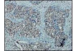 Immunohistochemistry (IHC) image for anti-Nitric Oxide Synthase 2, Inducible (NOS2) antibody (ABIN870301) (NOS2 antibody)