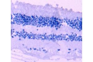 Immunohistochemistry (IHC) image for anti-Arrestin 3, Retinal (X-Arrestin) (ARR3) (C-Term) antibody (ABIN570667)