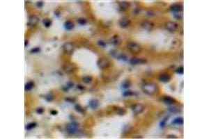 #VALUE! (Decorin antibody  (AA 31-359))