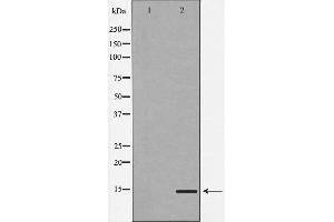 Western blot analysis of Hela cell lysate, using MAP1LC3A Antibody.