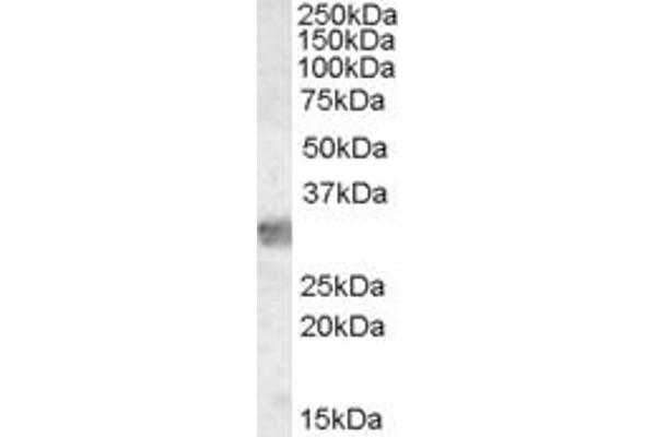 MYD88 antibody  (Internal Region)