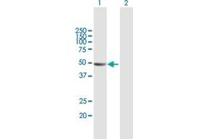 Western Blot analysis of KIAA1576 expression in transfected 293T cell line by KIAA1576 MaxPab polyclonal antibody. (VAT1L antibody  (AA 1-419))