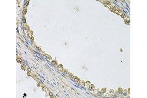 Immunohistochemistry of paraffin-embedded Human prostate using MTERFD1 Polyclonal Antibody at dilution of 1:100 (40x lens). (MTERFD1 antibody)