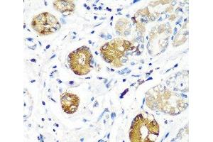 Immunohistochemistry of paraffin-embedded Human stomach using SGSH Polyclonal Antibody at dilution of 1:100 (40x lens). (SGSH antibody)