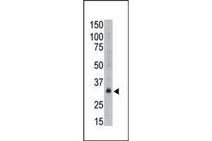 The anti-GEA6 C-term Antibody (ABIN390109 and ABIN2840621) is used in Western blot to detect GEA6 in A549 lysate. (MAGEA6 antibody  (C-Term))