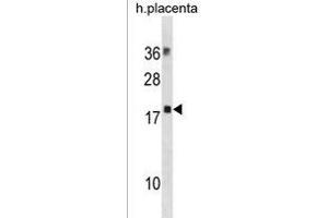 MYL12B Antibody (N-term) (ABIN1881561 and ABIN2838709) western blot analysis in human placenta tissue lysates (35 μg/lane). (MYL12B antibody  (N-Term))
