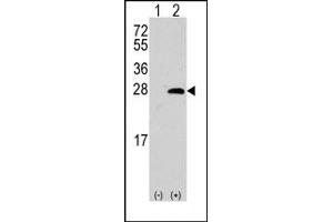 Image no. 1 for anti-sigma Non-Opioid Intracellular Receptor 1 (SIGMAR1) (Middle Region) antibody (ABIN357897) (SIGMAR1 antibody  (Middle Region))