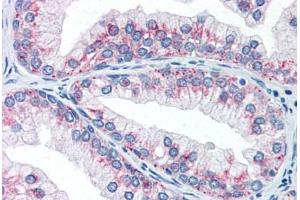 Human Prostate (formalin-fixed, paraffin-embedded) stained with AKT1S1 antibody ABIN337263 at 10 ug/ml followed by biotinylated anti-mouse IgG secondary antibody ABIN481714, alkaline phosphatase-streptavidin and chromogen. (PRAS40 antibody)