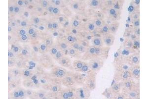 Detection of ATF6 in Mouse Liver Tissue using Polyclonal Antibody to Activating Transcription Factor 6 (ATF6) (ATF6 antibody  (AA 1-377))
