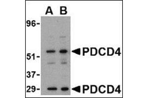 Western blot analysis of PDCD4 in A-20 cell lysate with this product at (A) 0. (PDCD4 antibody  (C-Term))