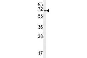 Western Blotting (WB) image for anti-Platelet/endothelial Cell Adhesion Molecule (PECAM1) (AA 508-536) antibody (ABIN3032259)