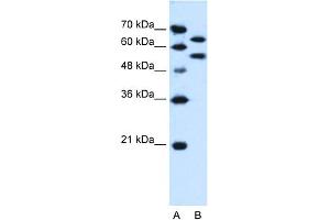 WB Suggested Anti-SIL1 Antibody Titration:  0. (SIL1 antibody  (N-Term))