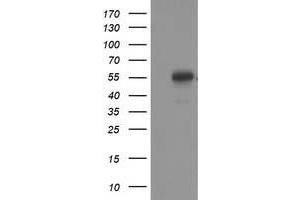 Western Blotting (WB) image for anti-Tumor Protein P53 (TP53) antibody (ABIN1499975) (p53 antibody)