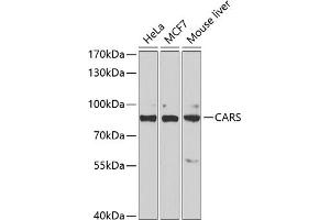 Western blot analysis of extracts of various cell lines, using CARS antibody (ABIN6129260, ABIN6137946, ABIN6137948 and ABIN6222203) at 1:1000 dilution. (CARS antibody  (AA 469-748))