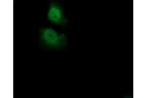 Immunofluorescence (IF) image for anti-Acireductone Dioxygenase 1 (ADI1) antibody (ABIN1496483) (ADI1 antibody)