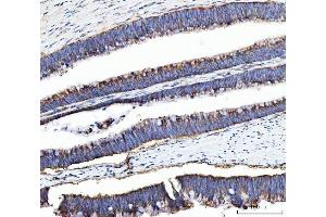 IHC analysis of UBA5 using anti-UBA5 antibody (ABIN7601503).