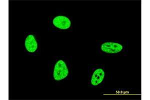 Immunofluorescence of monoclonal antibody to OXSR1 on HeLa cell. (OXSR1 antibody  (AA 351-450))