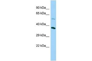 Host: Rabbit Target Name: NDUFAF5 Sample Type: Fetal Heart lysates Antibody Dilution: 1. (C20orf7 antibody  (N-Term))