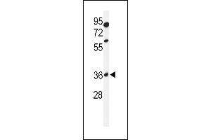 GLT8D2 antibody  (N-Term)