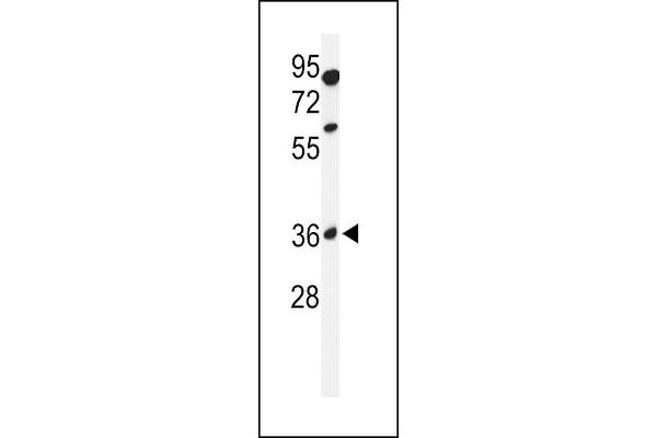 GLT8D2 antibody  (N-Term)